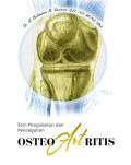 SENI PENGOBATAN PENCEGAHAN OSTEOARTRITIS