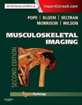 MUSCULOSKELETAL IMAGING. 2ND EDITION